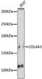 Collagen Type IV Alpha 3 Chain antibody, 16-569, ProSci, Western Blot image 