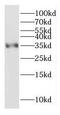 Cytochrome C1 antibody, FNab02119, FineTest, Western Blot image 
