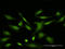 Voltage-dependent anion-selective channel protein 2 antibody, LS-C198424, Lifespan Biosciences, Immunofluorescence image 