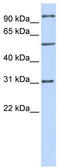 Retinoic Acid Induced 14 antibody, TA333809, Origene, Western Blot image 