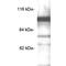 Phosphodiesterase 6C antibody, GTX17580, GeneTex, Western Blot image 