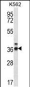 Ribonuclease P/MRP Subunit P38 antibody, PA5-48436, Invitrogen Antibodies, Western Blot image 