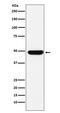 DExD-Box Helicase 39B antibody, M03490-3, Boster Biological Technology, Western Blot image 
