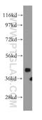 Snurportin-1 antibody, 15358-1-AP, Proteintech Group, Western Blot image 