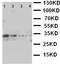Leukocyte tyrosine kinase receptor antibody, LS-C313121, Lifespan Biosciences, Western Blot image 