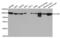 Chloride Voltage-Gated Channel 5 antibody, LS-C334230, Lifespan Biosciences, Western Blot image 