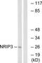 Nuclear Receptor Interacting Protein 3 antibody, TA312668, Origene, Western Blot image 