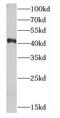 Cyclin Dependent Kinase 9 antibody, FNab01564, FineTest, Western Blot image 