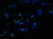 Probable palmitoyltransferase ZDHHC23 antibody, CSB-PA818262LA01HU, Cusabio, Immunofluorescence image 