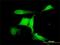 E3 ubiquitin-protein ligase RFWD2 antibody, H00064326-M01, Novus Biologicals, Immunocytochemistry image 