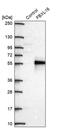 F-Box And Leucine Rich Repeat Protein 16 antibody, PA5-63291, Invitrogen Antibodies, Western Blot image 