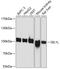 SEL1L Adaptor Subunit Of ERAD E3 Ubiquitin Ligase antibody, A03343, Boster Biological Technology, Western Blot image 
