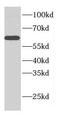 Cerebellar degeneration-related protein 2-like antibody, FNab01569, FineTest, Western Blot image 