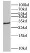 Nucleolar Protein 3 antibody, FNab05784, FineTest, Western Blot image 