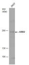 AT-Rich Interaction Domain 2 antibody, GTX129444, GeneTex, Western Blot image 