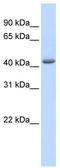 GA Binding Protein Transcription Factor Subunit Beta 1 antibody, TA329215, Origene, Western Blot image 