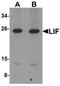 LIF Interleukin 6 Family Cytokine antibody, orb75589, Biorbyt, Western Blot image 
