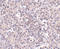 Solute Carrier Family 39 Member 10 antibody, A09043, Boster Biological Technology, Immunohistochemistry paraffin image 