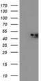 NADH:Ubiquinone Oxidoreductase Complex Assembly Factor 7 antibody, NBP2-00820, Novus Biologicals, Western Blot image 