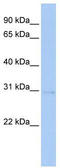 Serine/Threonine Kinase 16 antibody, TA346579, Origene, Western Blot image 