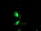Exosome Component 7 antibody, MA5-25850, Invitrogen Antibodies, Immunocytochemistry image 