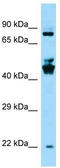 Speedy/RINGO Cell Cycle Regulator Family Member E3 antibody, TA344573, Origene, Western Blot image 