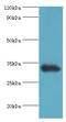 Uncoupling Protein 1 antibody, LS-C376978, Lifespan Biosciences, Western Blot image 