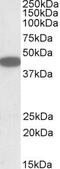 C-X-C Motif Chemokine Receptor 6 antibody, PA5-19301, Invitrogen Antibodies, Western Blot image 