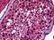 SP140 Nuclear Body Protein antibody, 51-907, ProSci, Immunohistochemistry paraffin image 