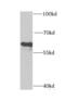 Cytochrome P450 Family 46 Subfamily A Member 1 antibody, FNab02167, FineTest, Western Blot image 