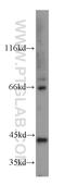 Guanine nucleotide-binding protein subunit alpha-14 antibody, 13350-1-AP, Proteintech Group, Western Blot image 