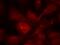 Serine/threonine-protein kinase PAK 3 antibody, GTX50865, GeneTex, Immunofluorescence image 