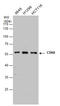 Cyclin Dependent Kinase 8 antibody, GTX110495, GeneTex, Western Blot image 