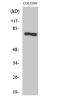 H2.0-like homeobox protein antibody, A06177, Boster Biological Technology, Western Blot image 