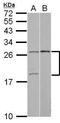 YY1 Associated Factor 2 antibody, GTX115355, GeneTex, Western Blot image 