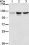 N-Acetyltransferase 10 antibody, PA5-50459, Invitrogen Antibodies, Western Blot image 