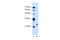 Motile sperm domain-containing protein 3 antibody, ARP44910_T100, Aviva Systems Biology, Western Blot image 