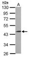 Leucine Rich Repeat Containing 2 antibody, NBP2-19374, Novus Biologicals, Western Blot image 