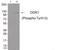 Discoidin Domain Receptor Tyrosine Kinase 1 antibody, 79-881, ProSci, Western Blot image 