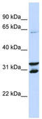 F-Box Protein 24 antibody, TA329819, Origene, Western Blot image 