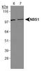 Nibrin antibody, TA336721, Origene, Western Blot image 