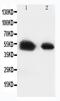 Solute Carrier Family 2 Member 8 antibody, PA5-80025, Invitrogen Antibodies, Western Blot image 