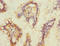 Sterol O-Acyltransferase 2 antibody, LS-C676531, Lifespan Biosciences, Immunohistochemistry paraffin image 