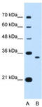 NDRG Family Member 2 antibody, TA342551, Origene, Western Blot image 