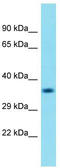 Regulator Of MON1-CCZ1 antibody, TA331990, Origene, Western Blot image 