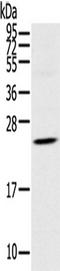 Tetraspanin 13 antibody, TA351817, Origene, Western Blot image 