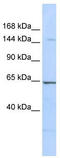 Arginine-Glutamic Acid Dipeptide Repeats antibody, TA331119, Origene, Western Blot image 