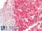CD63 Molecule antibody, LS-B16509, Lifespan Biosciences, Immunohistochemistry paraffin image 