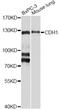 Cadherin 1 antibody, A3044, ABclonal Technology, Western Blot image 