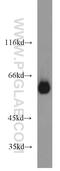 TYRP2 antibody, 13095-1-AP, Proteintech Group, Western Blot image 
